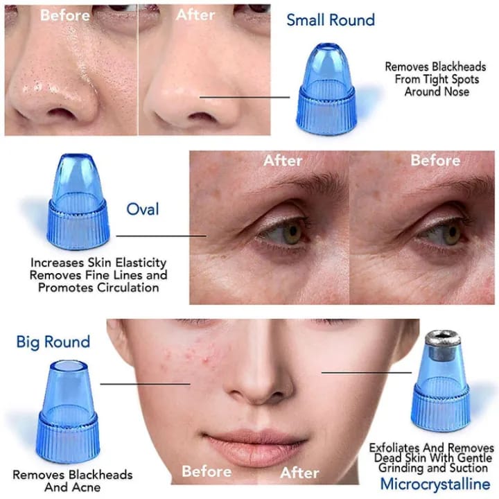 Derma suction